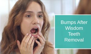 Bumps After Wisdom Teeth Removal