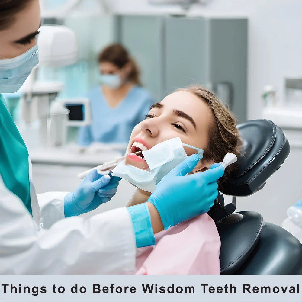 Things to do before wisdom teeth removal
