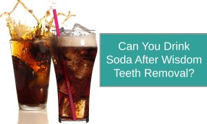 Can You Drink Soda After Wisdom Teeth Removal?