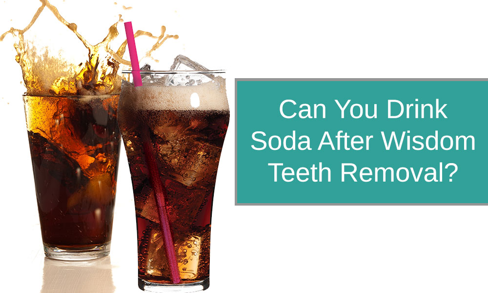 Can You Drink Soda After Wisdom Teeth Removal?