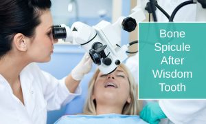 Bone Spicule After Wisdom Tooth Extraction