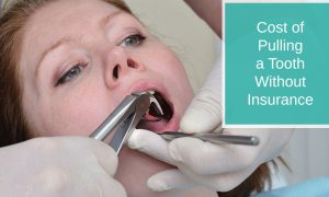 Cost of Pulling a Tooth Without Insurance
