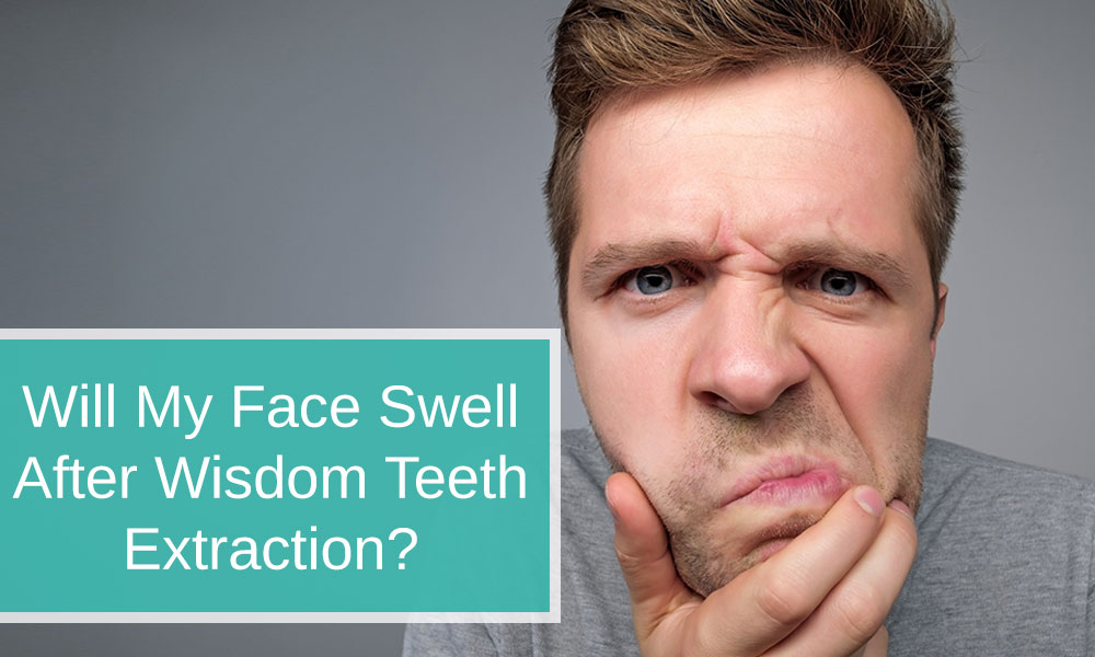 Will my Face Swell After Wisdom Teeth Extraction?
