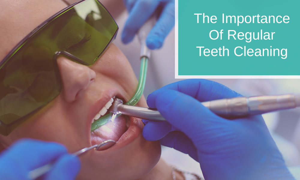 The Importance of Regular Teeth Cleaning