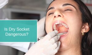 Is Dry Socket Dangerous?