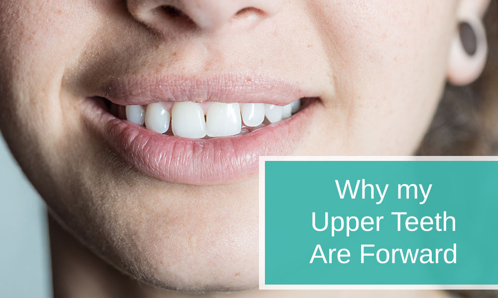 Why my Upper Teeth Are Forward